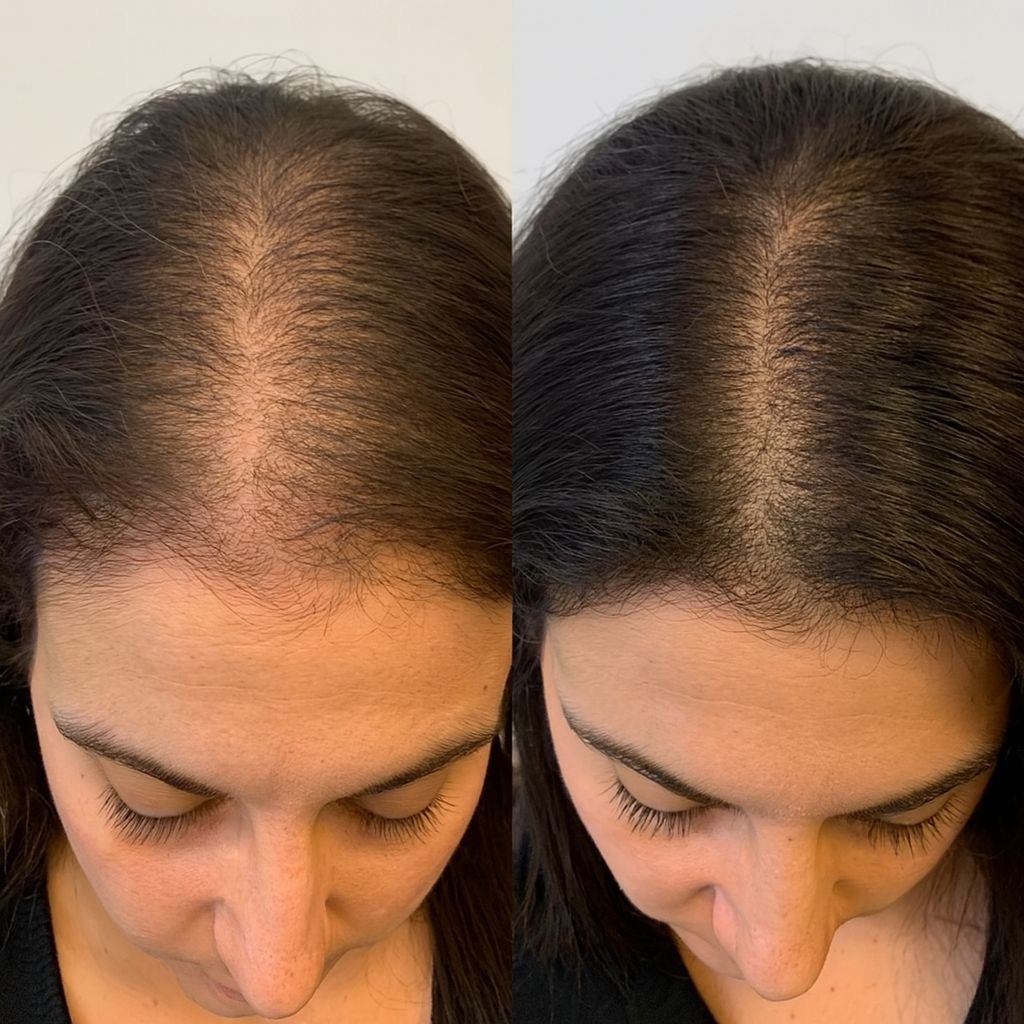 Hair Serum